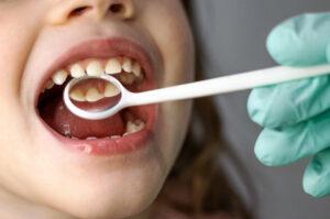 How Often a Child Should See the Dentist