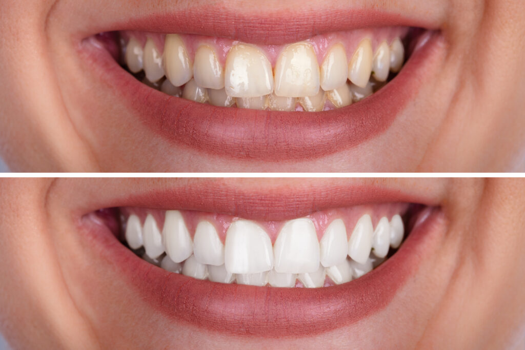 What’s Possible at Zielinski Family Dentistry