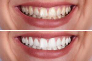What’s Possible at Zielinski Family Dentistry